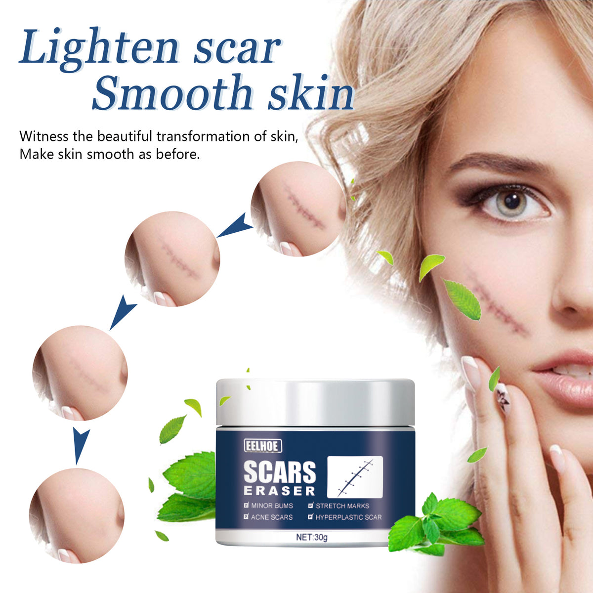 EELHOE Scar Care Balm with Jojoba Seed Oil