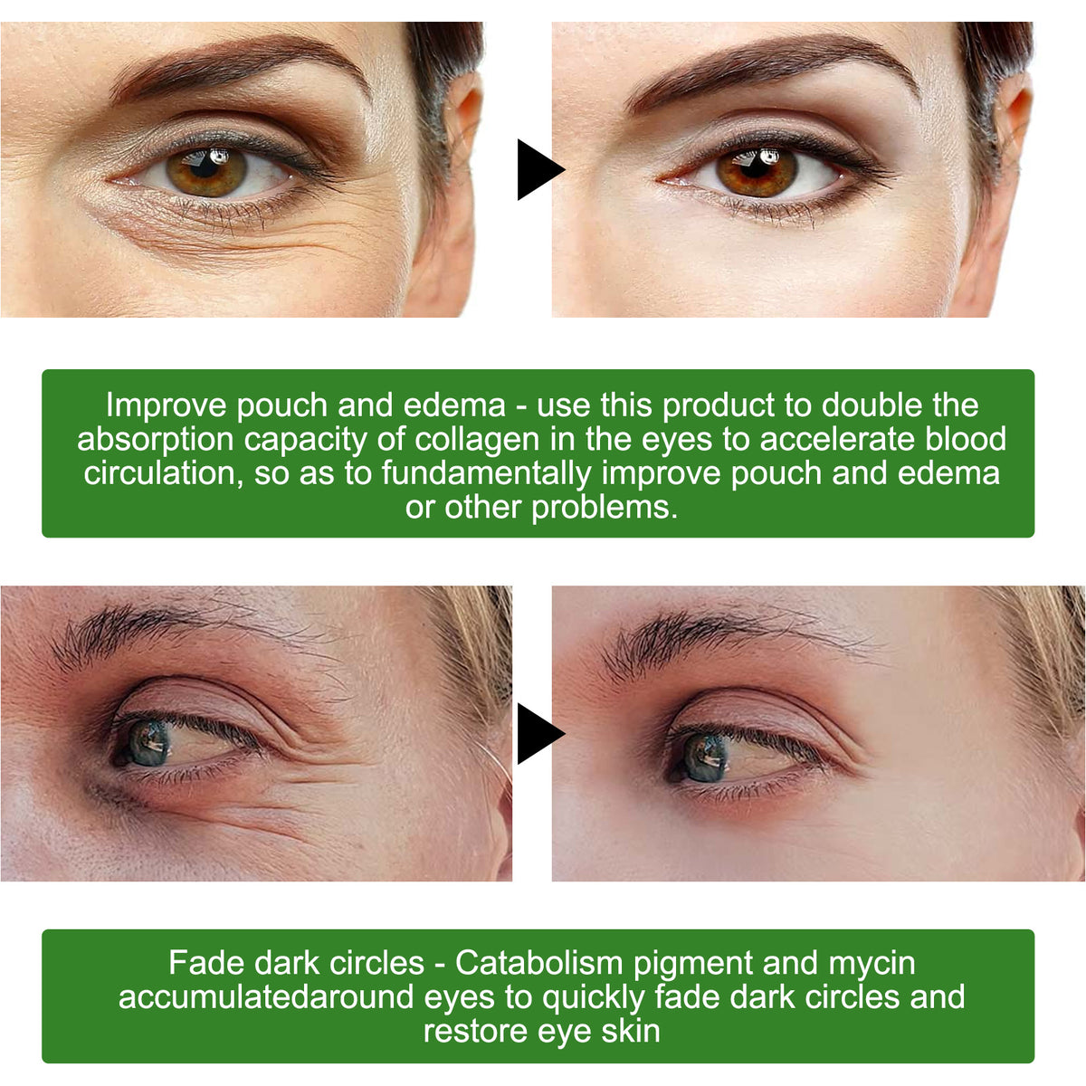 EELHOE Seaweed Eye Mask
